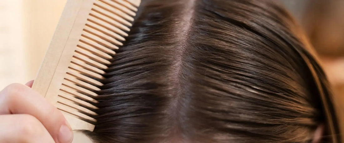 Cuidado del Cuero Cabelludo: Soluciones para una Cabellera Radiante